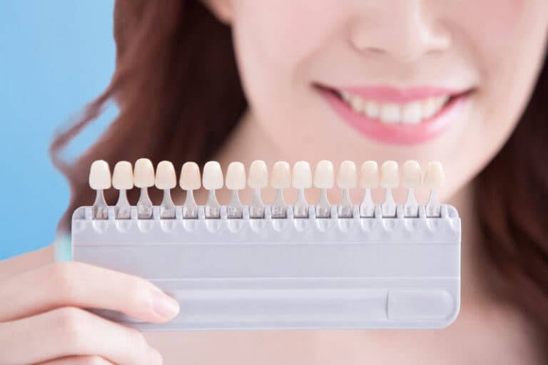 Transform Your Smile with Porcelain Veneers in Gilbert
